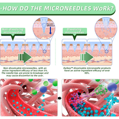 [See results in 7 days]👨‍⚕️Cvreoz® SMGT-GLP-1 Nano Microneedle Patch（Painless, long-lasting, addressing diabetes, obesity, and cardiovascular diseases）