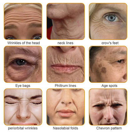 🔥Last Day Promotion 70% OFF ! - 💝Flysmus™ Collagen Peptides Wrinkle Removal Cream